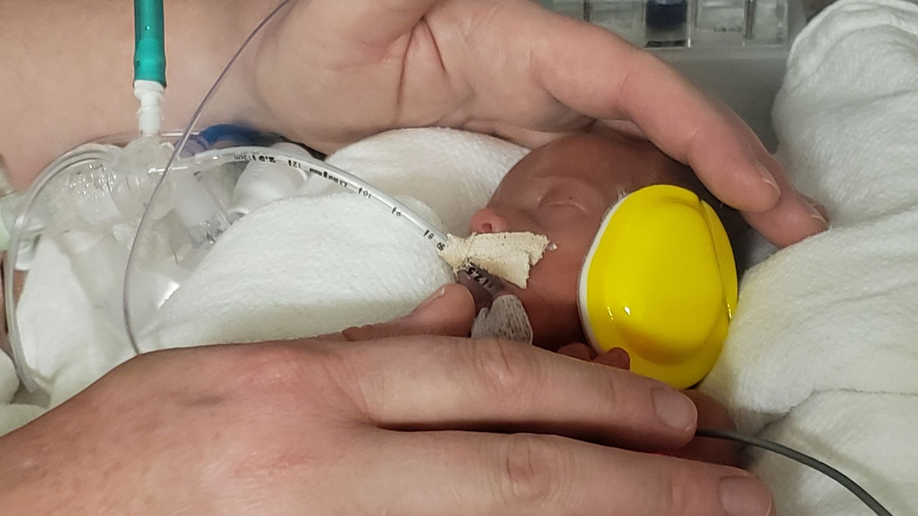 a nicu baby sleeps while a parent places their hands near the baby