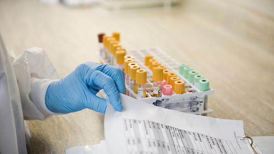 Lab technician with blood samples and medical chart 